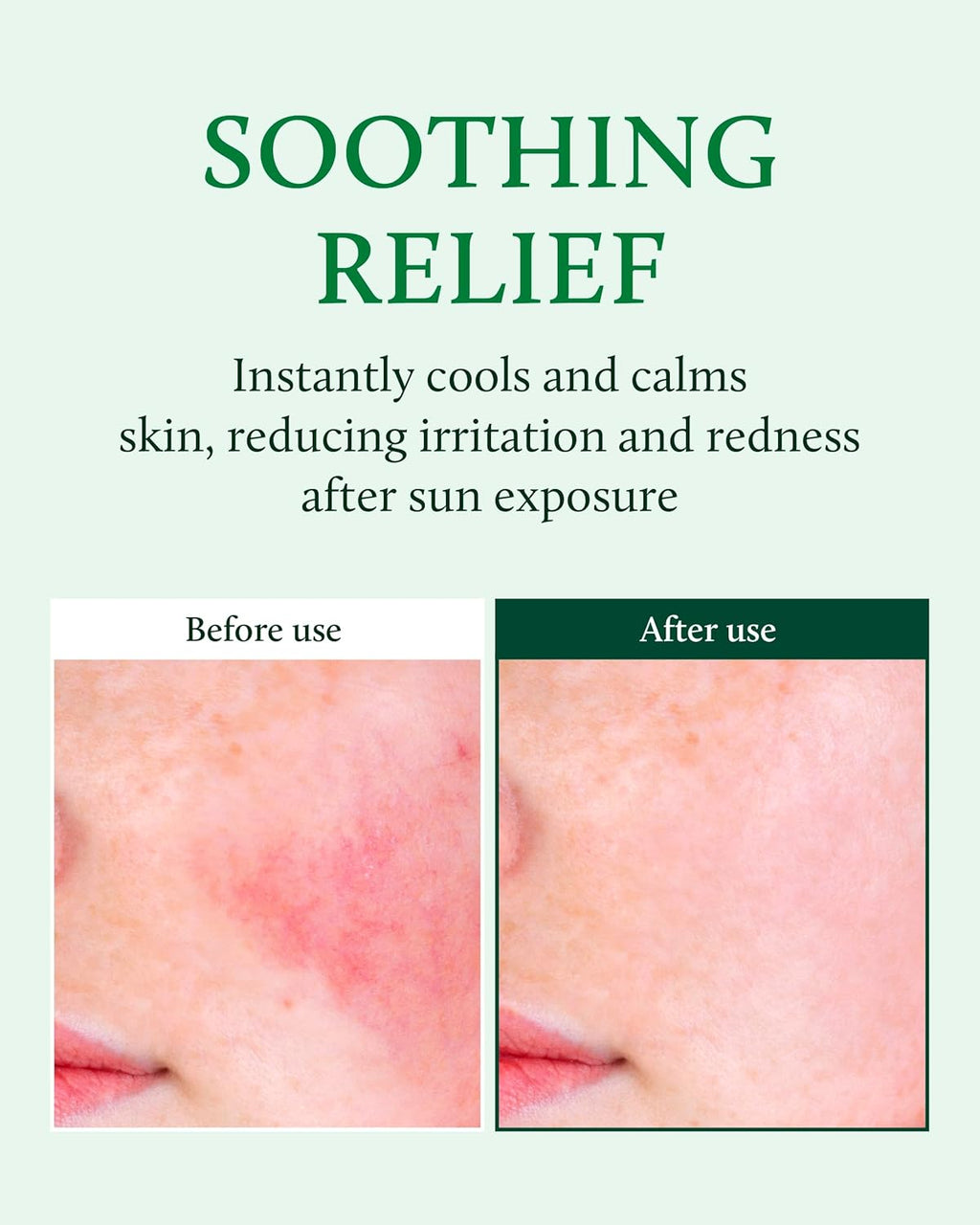 Cactus Soothing Gel 8.45Fl Oz & Cactus Green Hydra Serum 1.01Fl Oz - Vegan Sunburn Relief, Cool & Soothe Irritated Skin, Face Redness. Korean Skin Care Hydration Oil-Moisture Balance Niacinamide